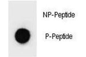Dot blot analysis of p-PARP1 antibody.