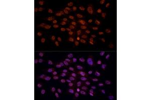 Immunofluorescence analysis of C6 cells using CRYGC antibody (ABIN6130868, ABIN6139079, ABIN6139080 and ABIN6224977) at dilution of 1:100 (40x lens). (CRYGC 抗体  (AA 1-174))