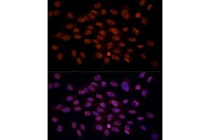 Immunofluorescence analysis of C6 cells using CRYGC antibody (ABIN6130868, ABIN6139079, ABIN6139080 and ABIN6224977) at dilution of 1:100 (40x lens).
