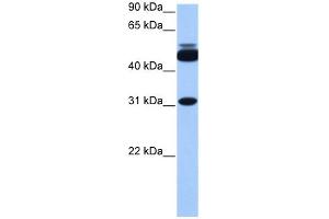 WB Suggested Anti-CYLC2 Antibody Titration: 0. (CYLC2 抗体  (C-Term))