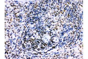 Anti- Ikaros Picoband antibody, IHC(P) IHC(P): Rat Spleen Tissue (IKZF1 抗体  (C-Term))
