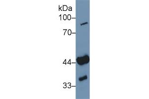 Detection of ADA in Human Jurkat cell lysate using Polyclonal Antibody to Adenosine Deaminase (ADA) (ADA 抗体  (AA 11-280))