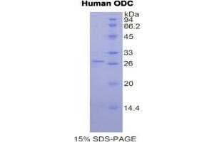 SDS-PAGE analysis of Human ODC Protein. (ODC1 蛋白)