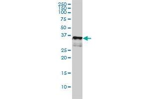 CD1A monoclonal antibody (M01), clone M1-2-1B5 Western Blot analysis of CD1A expression in K-562 . (CD1a 抗体  (AA 1-311))