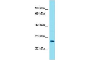 Western Blotting (WB) image for anti-Glutathione S-Transferase theta 2 (GSTT2) (Middle Region) antibody (ABIN2789659) (GSTT2 抗体  (Middle Region))