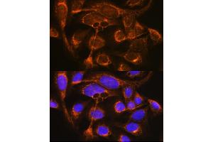 Immunofluorescence analysis of U-2 OS cells using CFP Rabbit pAb (ABIN6127651, ABIN6138467, ABIN6138468 and ABIN6221045) at dilution of 1:100 (40x lens).