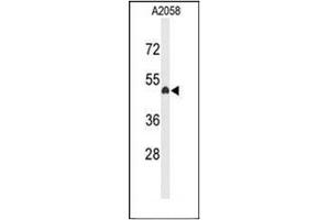 Western blot analysis of EYA4 Antibody (C-term) in A2058 cell line lysates (35ug/lane). (EYA4 抗体  (C-Term))