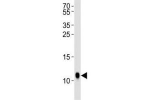Western blot analysis of lysate from Drosophila tissue lysate using SUMO antibody diluted at 1:1000. (SUMO 抗体  (AA 37-66))