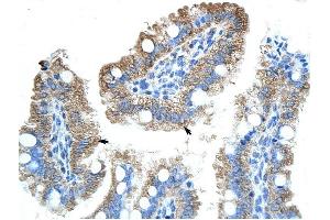 GTPBP9 antibody was used for immunohistochemistry at a concentration of 4-8 ug/ml to stain Epithelial cells of intestinal villus (arrows) in Human Intestine. (OLA1 抗体)