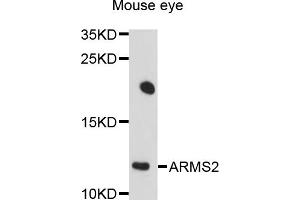 Western blot analysis of extracts of mouse eye, using ARMS2 antibody (ABIN4902948) at 1:1000 dilution. (ARMS2 抗体)