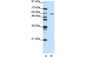 WB Suggested Anti-ZNF382 Antibody Titration:  1. (ZNF382 抗体  (N-Term))