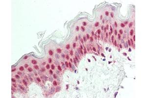 Human Skin: Formalin-Fixed, Paraffin-Embedded (FFPE). (POU2F3 抗体  (N-Term))