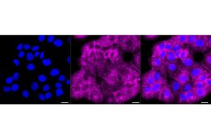 anti-Lymphatic Vessel Endothelial Hyaluronan Receptor 1 (LYVE1) antibody