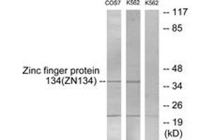 Western Blotting (WB) image for anti-Zinc Finger Protein 134 (ZNF134) (AA 116-165) antibody (ABIN2889510) (ZNF134 抗体  (AA 116-165))