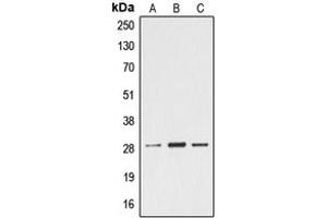 Western blot analysis of Ephrin A4 expression in Jurkat (A), mouse heart (B), rat heart (C) whole cell lysates. (EFNA4 抗体  (C-Term))