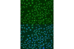 Immunofluorescence analysis of U2OS cells using ELAVL1 antibody (ABIN6292898) at dilution of 1:100. (ELAVL1 抗体)