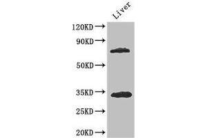 Western Blot Positive WB detected in: Mouse liver tissue All lanes: HDAC10 antibody at 3. (HDAC1 抗体  (AA 207-412))