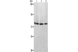 Gel: 8 % SDS-PAGE, Lysate: 40 μg, Lane 1-3: Mouse stomach tissue, Mouse liver tissue, Mouse kidney tissue, Primary antibody: ABIN7128170(ACOX1 Antibody) at dilution 1/350, Secondary antibody: Goat anti rabbit IgG at 1/8000 dilution, Exposure time: 1 minute (ACOX1 抗体)