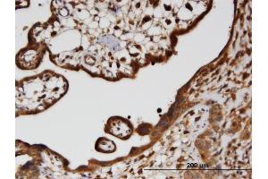Immunoperoxidase of monoclonal antibody to HECTD2 on formalin-fixed paraffin-embedded human placenta. (HECTD2 抗体  (AA 331-440))