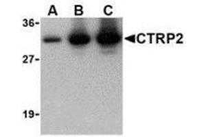 Western blot of recombinant CTRP2: (A) 5 ng, (B) 25 ng, and (C) 50 ng with AP30250PU-N CTRP2 at 1 ug/ml. (C1QTNF2 抗体)