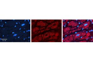 Rabbit Anti-PHB2 Antibody   Formalin Fixed Paraffin Embedded Tissue: Human heart Tissue Observed Staining: Cytoplasmic Primary Antibody Concentration: 1:100 Other Working Concentrations: 1:600 Secondary Antibody: Donkey anti-Rabbit-Cy3 Secondary Antibody Concentration: 1:200 Magnification: 20X Exposure Time: 0. (Prohibitin 2 抗体  (N-Term))