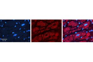 Rabbit Anti-PHB2 Antibody   Formalin Fixed Paraffin Embedded Tissue: Human heart Tissue Observed Staining: Cytoplasmic Primary Antibody Concentration: 1:100 Other Working Concentrations: 1:600 Secondary Antibody: Donkey anti-Rabbit-Cy3 Secondary Antibody Concentration: 1:200 Magnification: 20X Exposure Time: 0. (Prohibitin 2 抗体  (N-Term))