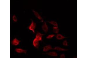 ABIN6274969 staining RAW264. (CPE 抗体  (Internal Region))