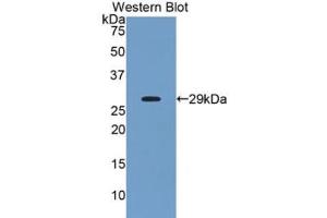Western blot analysis of recombinant Human ANGPTL2.