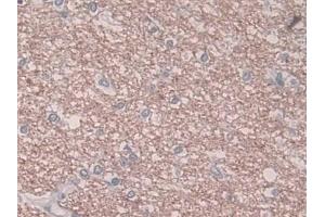 Immunohistochemistry (IHC) image for anti-Plasminogen Activator Inhibitor 1 (SERPINE1) antibody (ABIN7427915)