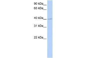 WB Suggested Anti-PAX1 Antibody Titration: 0. (PAX1 抗体  (Middle Region))