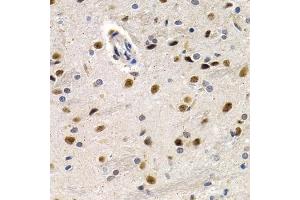 Immunohistochemistry of paraffin-embedded rat brain using ID3 antibody (ABIN6130481, ABIN6142140, ABIN6142141 and ABIN6221020) at dilution of 1:200 (40x lens). (ID3 抗体  (AA 1-119))