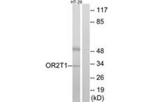 Western Blotting (WB) image for anti-Similar To Olfactory Receptor, Family 2, Subfamily T, Member 1 (OR2T1) (AA 231-280) antibody (ABIN2890990) (OR2T1 抗体  (AA 231-280))
