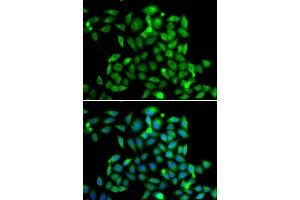 Immunofluorescence analysis of A549 cells using CLASP1 antibody. (CLASP1 抗体)