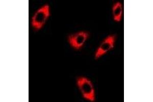 Immunofluorescent analysis of GTL3 staining in A549 cells. (C16orf80 抗体)
