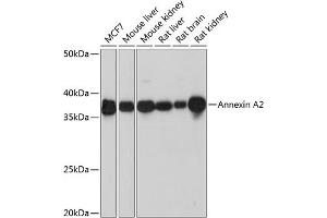 Western blot analysis of extracts of various cell lines, using Annexin  Rabbit mAb (ABIN7265619) at 1:1000 dilution. (Annexin A2 抗体)