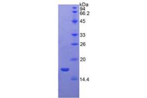 SDS-PAGE analysis of Rat VEGFB Protein. (VEGFB 蛋白)