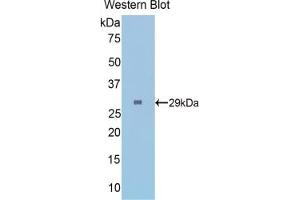 Detection of Recombinant FGg, Mouse using Polyclonal Antibody to Fibrinogen Gamma (FGg) (FGG 抗体  (AA 168-405))