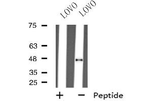 Western blot analysis of extracts from LOVO cells, using GHRHR antibody.