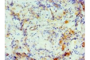 Immunohistochemistry of paraffin-embedded human testis tissue using ABIN7149061 at dilution of 1:100 (CRISP2 抗体  (AA 22-243))