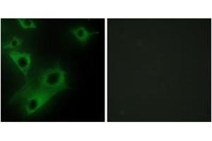 Immunofluorescence analysis of HeLa cells, using CIDEC Antibody. (CIDEC 抗体  (AA 189-238))