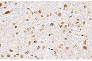 Immunohistochemistry of paraffin-embedded Rat brain using CBX6 Polyclonal Antibody at dilution of 1:100 (40x lens). (CBX6 抗体)