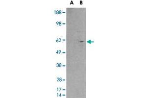 HEK293 overexpressing RXRB and probed with RXRB polyclonal antibody  (mock transfection in first lane), tested by Origene. (Retinoid X Receptor beta 抗体)