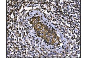 IHC analysis of IGF2R using anti-IGF2R antibody (ABIN7601706).