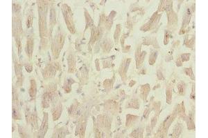 Immunohistochemistry of paraffin-embedded human heart tissue using ABIN7160958 at dilution of 1:100 (NDUFS3 抗体  (AA 37-264))