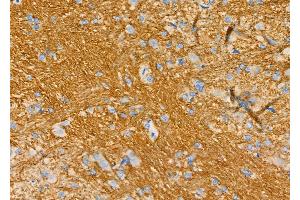 ABIN6266242 and ABIN6277394 at 1/100 staining Rat brain tissue by IHC-P. (Kallikrein 5 抗体  (Internal Region))