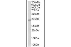 Image no. 1 for anti-Hydroxysteroid (11-Beta) Dehydrogenase 1 (HSD11B1) (C-Term) antibody (ABIN374504) (HSD11B1 抗体  (C-Term))
