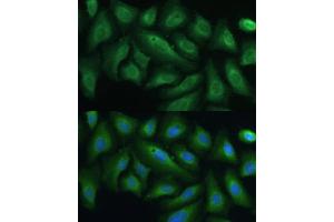 Immunofluorescence (IF) image for anti-Tyrosine-Protein Phosphatase Non-Receptor Type 22 (PTPN22) (AA 1-90) antibody (ABIN1513449)