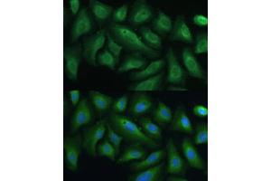 Immunofluorescence analysis of U-2 OS cells using PTPN22 antibody (ABIN3021952, ABIN3021953, ABIN1513449 and ABIN6218285) at dilution of 1:100. (PTPN22 抗体  (AA 1-90))