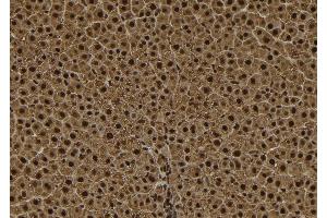 ABIN6278564 at 1/100 staining Rat liver tissue by IHC-P. (TPX2 抗体  (C-Term))