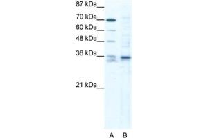 Western Blotting (WB) image for anti-SRY (Sex Determining Region Y)-Box 12 (SOX12) antibody (ABIN2460696) (SOX12 抗体)